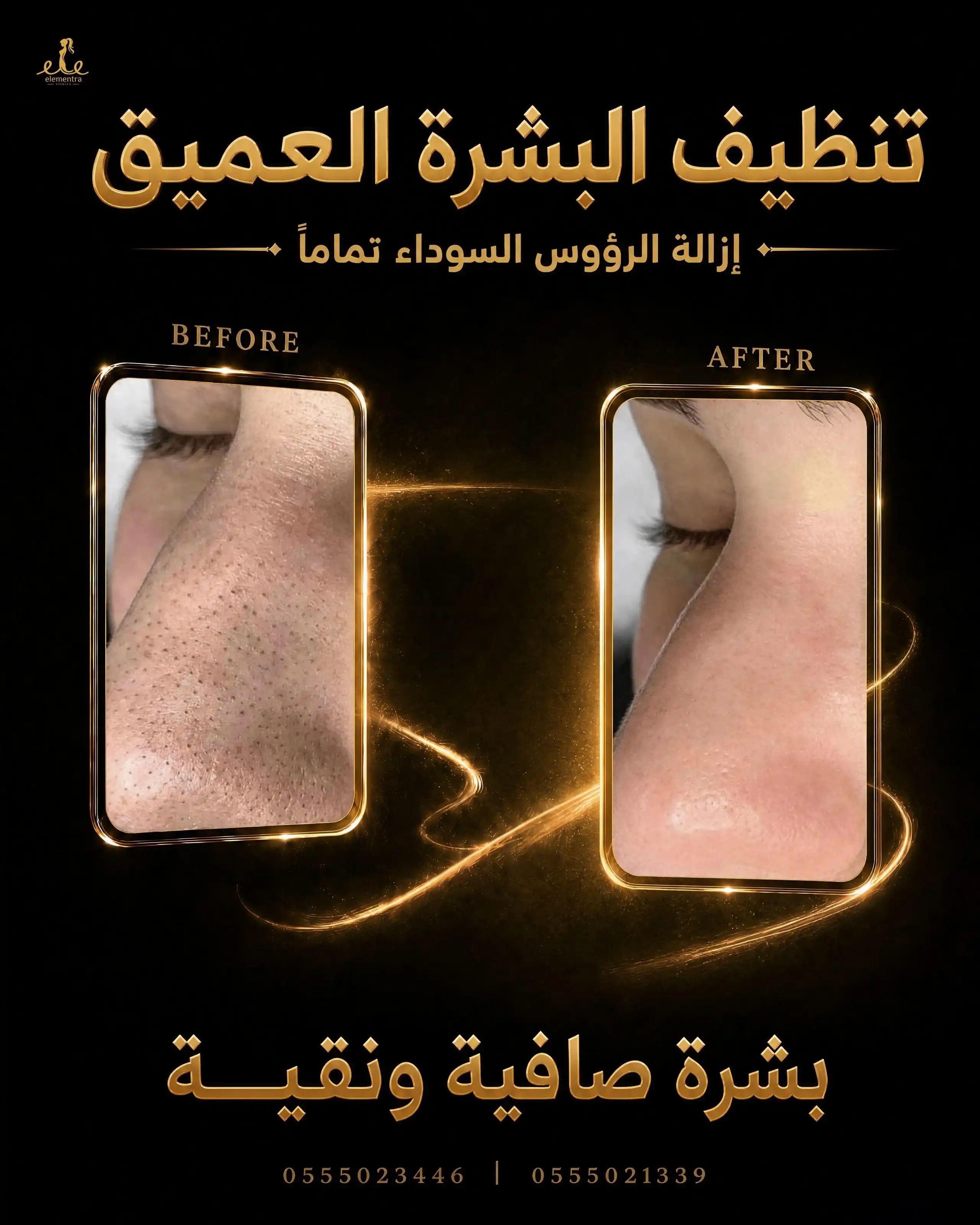 تنظيف البشرة العميق