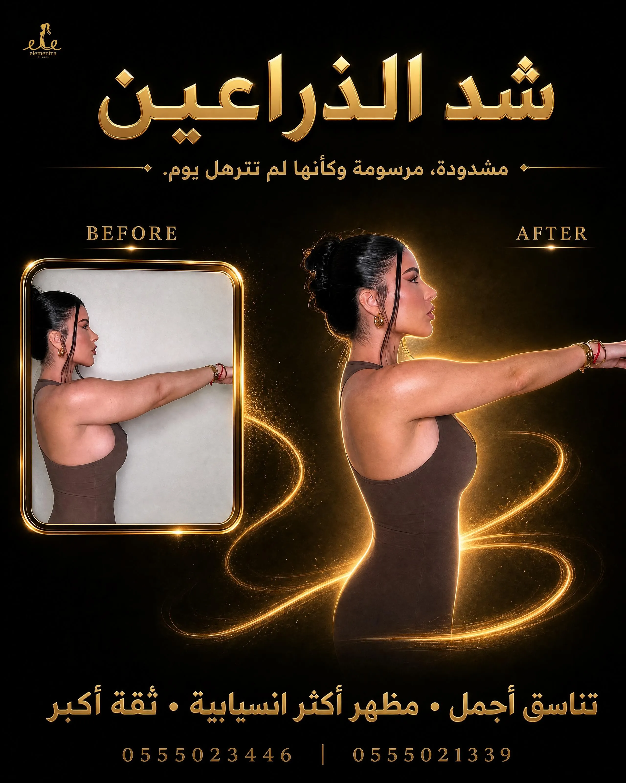 شد الذراعين 2