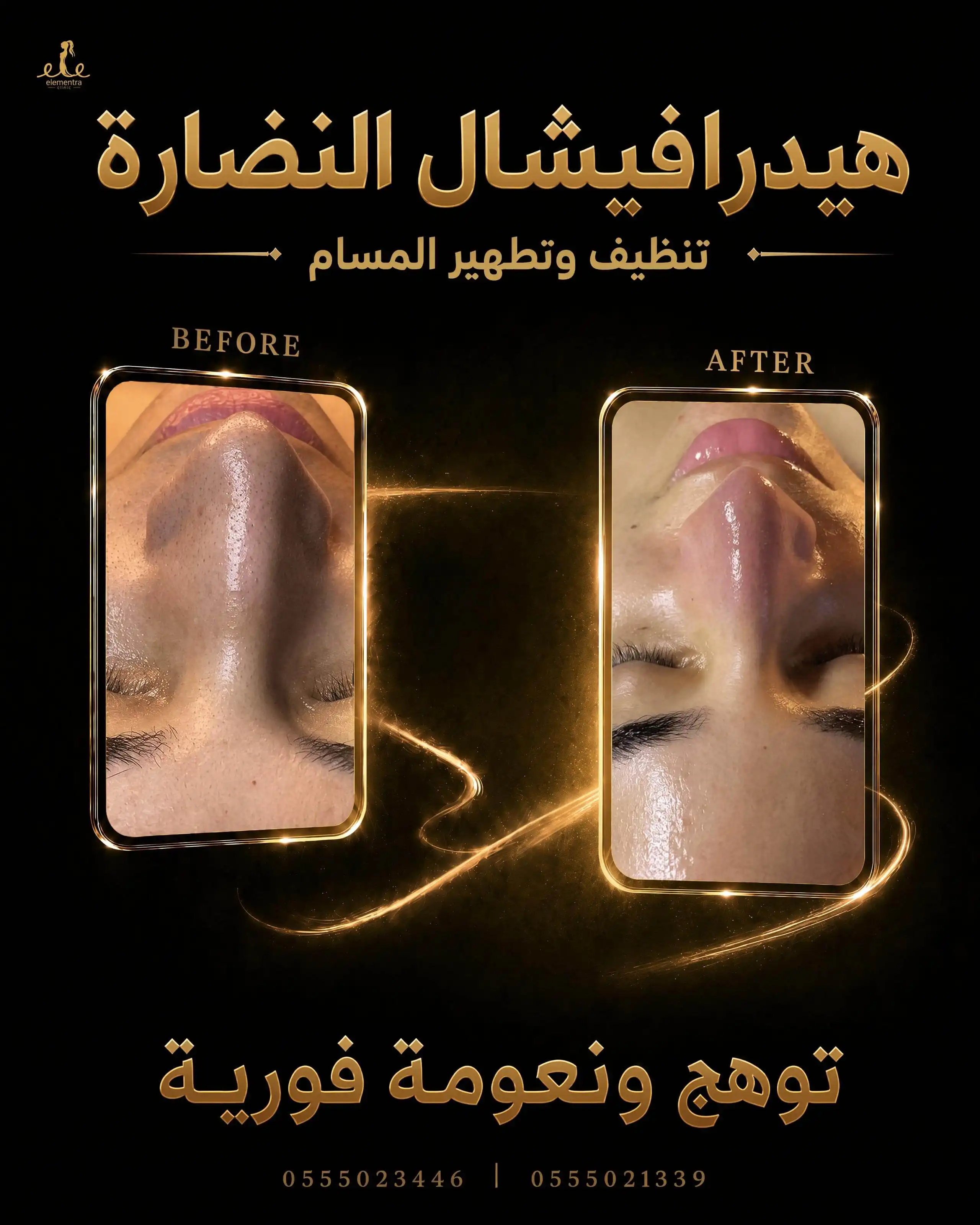 هيدرافيشال النضارة